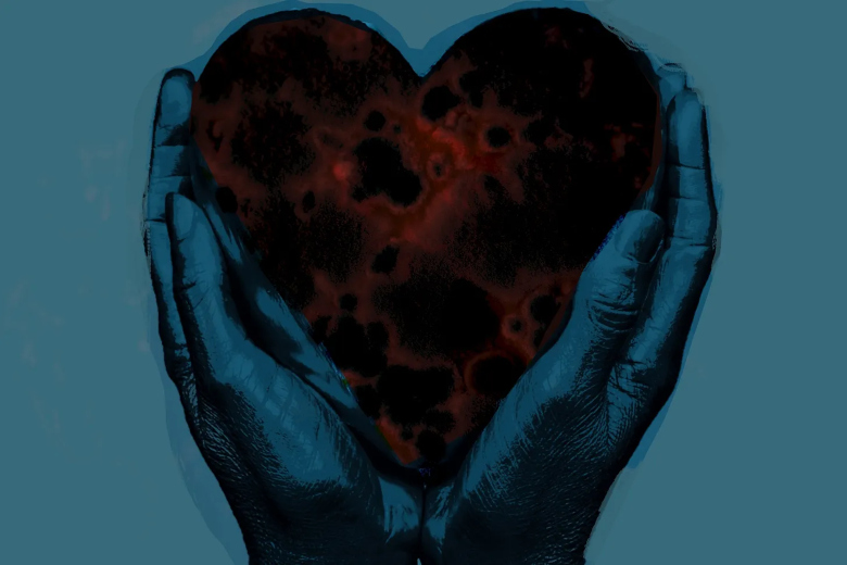 artistic graphic of a diseased heart held between two hands
