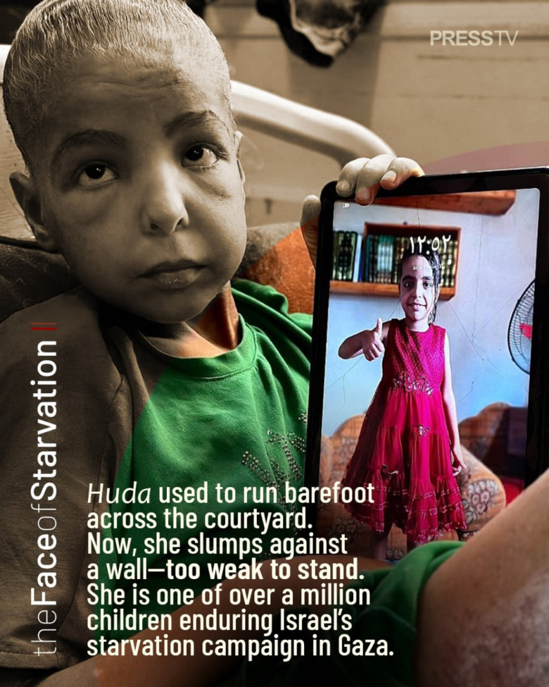 starving child in Gaza